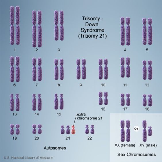 Down Syndrome