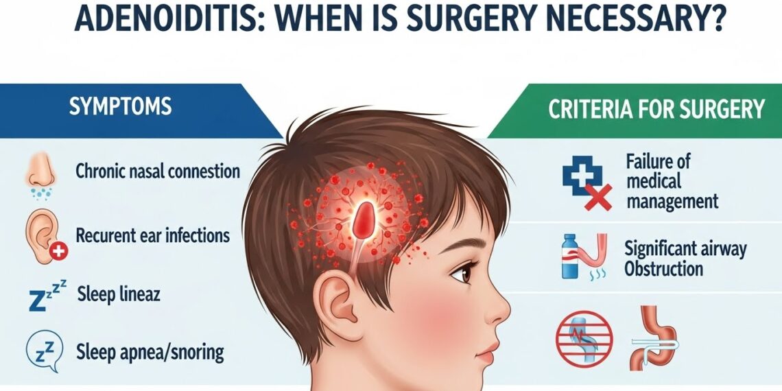 Adenoidid: When Is Surgery Necessary?