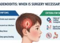 Adenoidid: When Is Surgery Necessary?