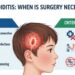 Adenoidid: When Is Surgery Necessary?
